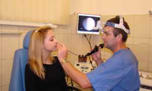 Проведении гастроскопии через нос: важные аспекты и рекомендации