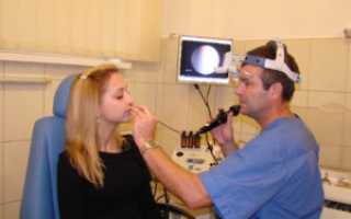 Проведении гастроскопии через нос: важные аспекты и рекомендации