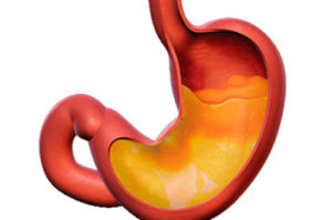 Снижение уровня кислотности в желудке