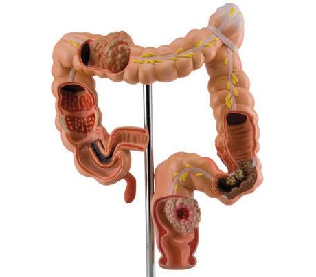 врожденный порок органов пищеварения