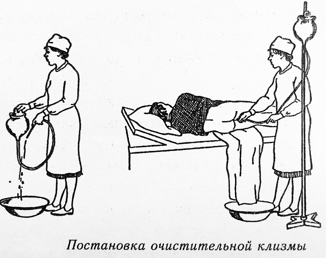 Как правильно делать клизму?