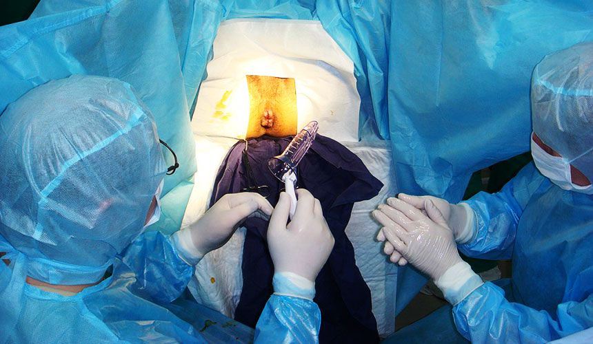 Хирургическое вмешательство при геморрое