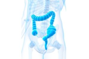 Дисбактериоз как одна из причин запора