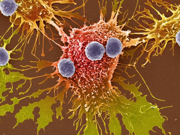 Малигнизация - что это?