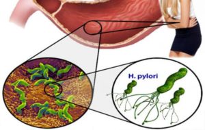 Хеликобактер пилори