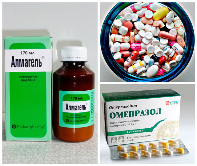 Лечение гастрита