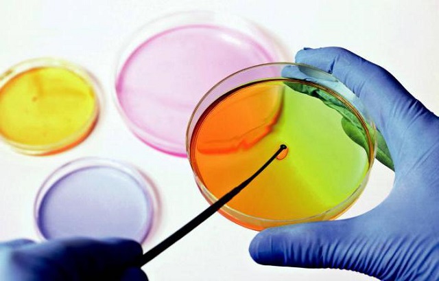 Исследование кала и мочи