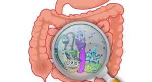 дисбактериоз