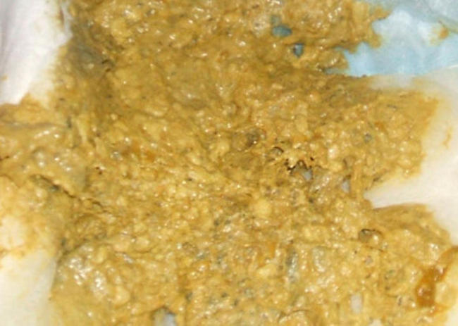 Понос у новорожденного