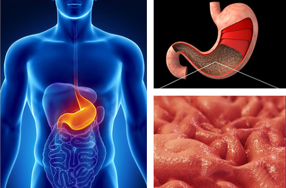 гастрит с пониженной кислотностью
