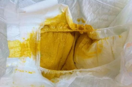 Понос у грудничка