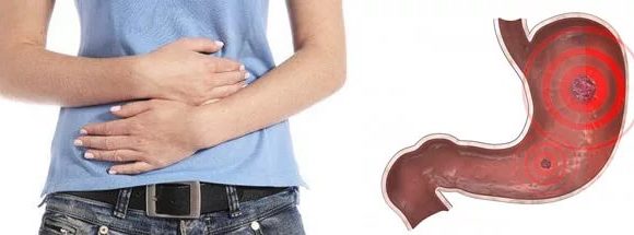 Алкоголь и язва желудка