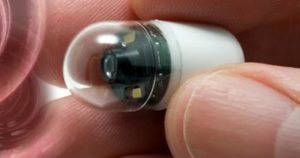 капсульная гастроскопия