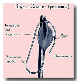 Устройство кружки Эсмарха
