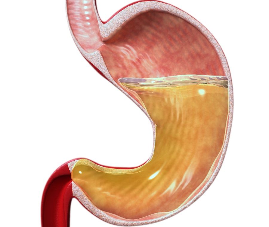 нейтрализация повышенной кислотности желудка