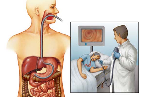осмотр ДПК при ФГС