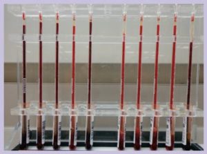 высокий показатель СОЭ