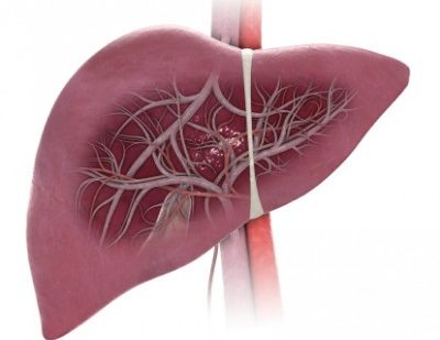 проблемы с печенью