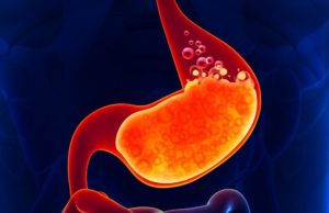 снижение уровня кислотности в желудке препаратом Омез