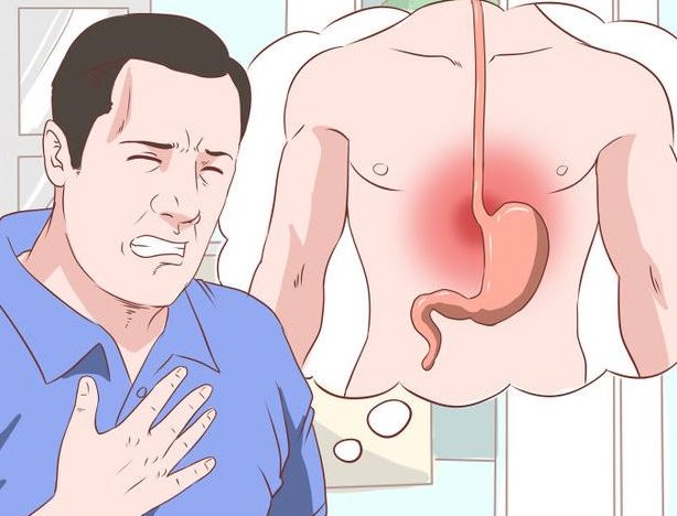 Поверхностный гастрит