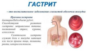 Причины гастрита