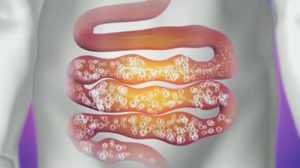 Газообразование в кишечнике