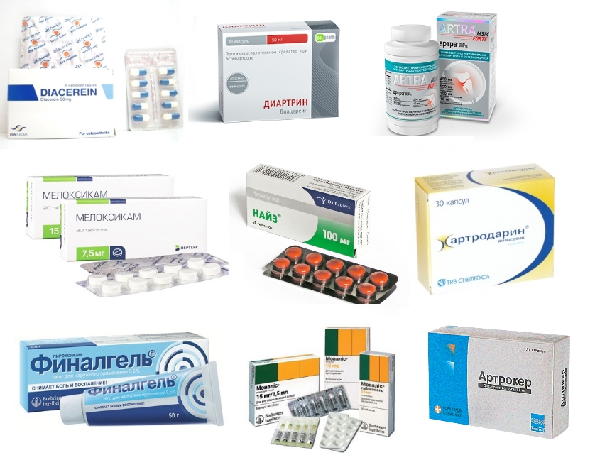 Аналоги Диафлекса Аналоги Диафлекса