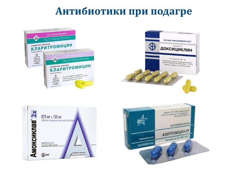 Антибиотики при подагре суставов