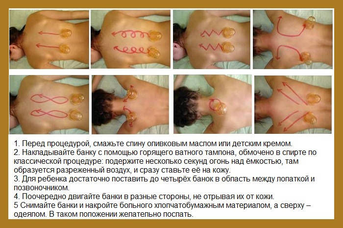 Баночный массаж