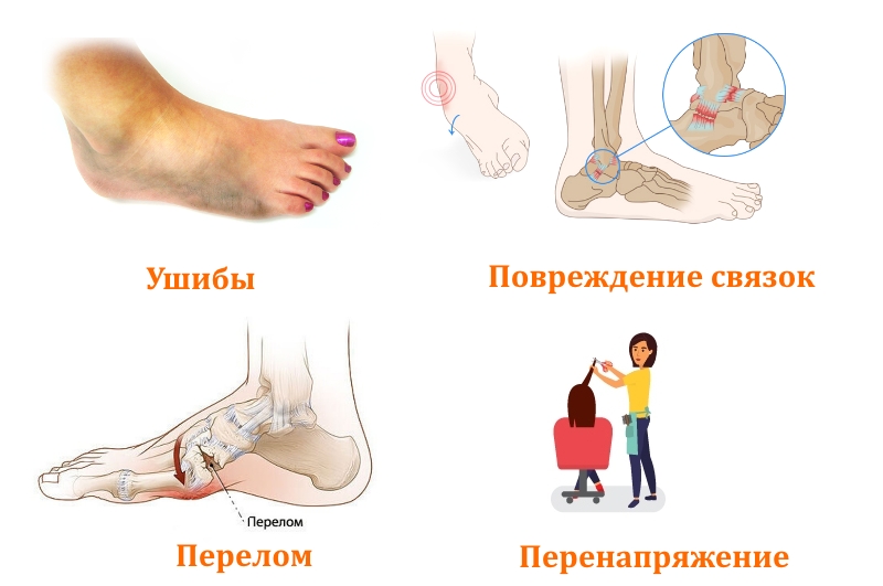 Боли в ступнях вследствие травм Боли в ступнях вследствие травм