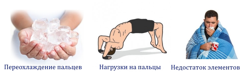 Частые причины онемения пальцев Частые причины онемения пальцев