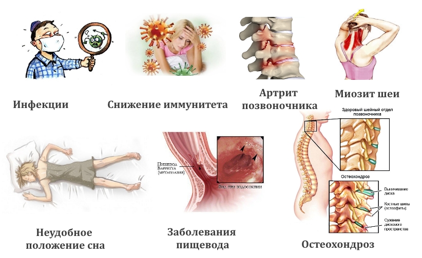 Частые причины шейной боли Частые причины шейной боли