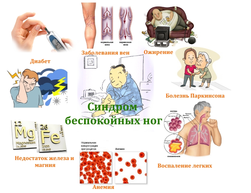 Частые причины синдрома беспокойных ног Частые причины синдрома беспокойных ног