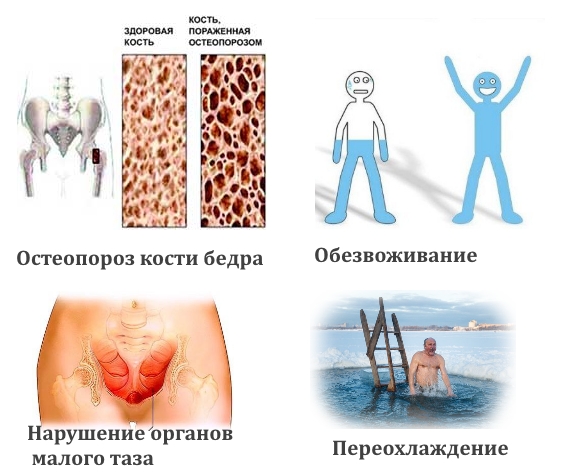 Частые причины судорог бедра Частые причины судорог бедра