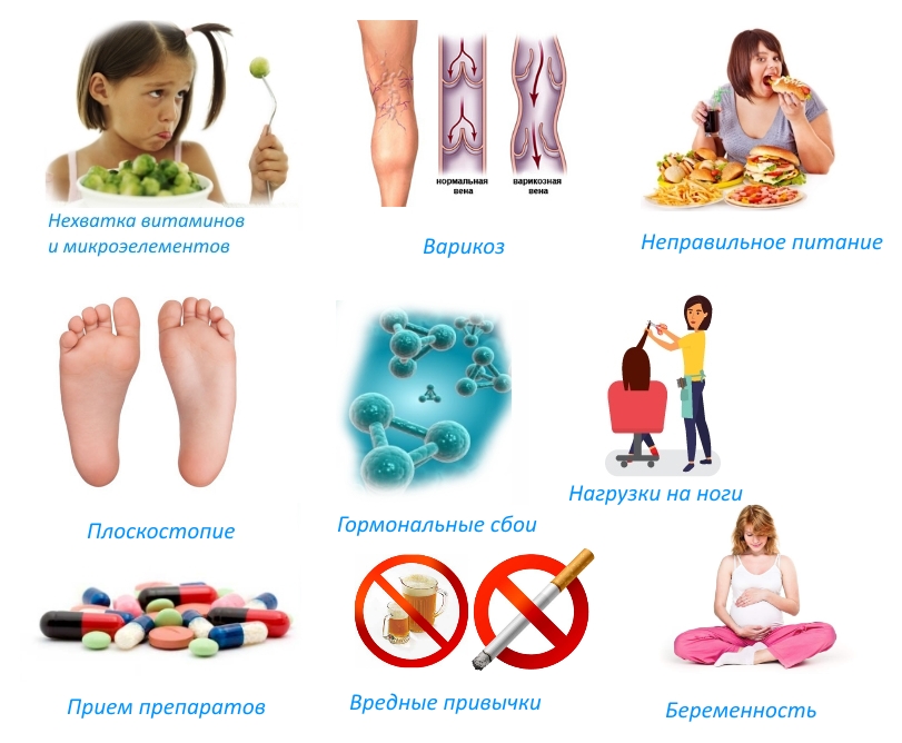 Частые причины судорог в ногах Частые причины судорог в ногах