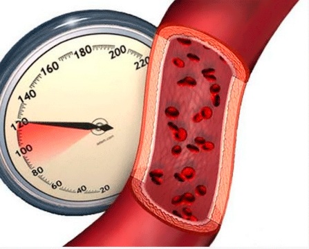 Давление и сосуды Давление и сосуды