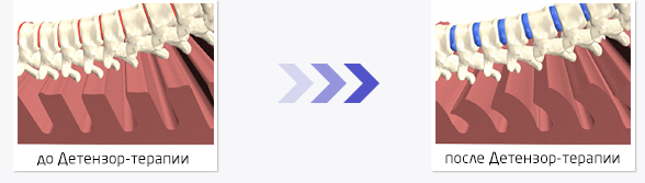 Позвоночник после детензор-терапии Позвоночник после детензор-терапии