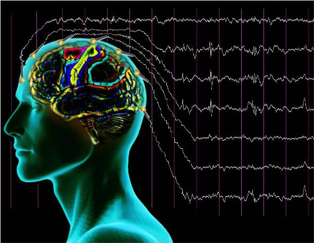 Электроэнцефалография сосудов мозга Электроэнцефалография сосудов мозга