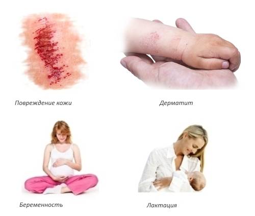 Противопоказания для геля-бальзама 911 Противопоказания для геля-бальзама 911