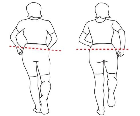 Хромота Хромота