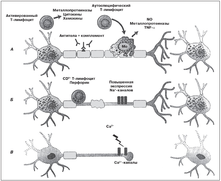 Иммуносупрессивная терапия Иммуносупрессивная терапия