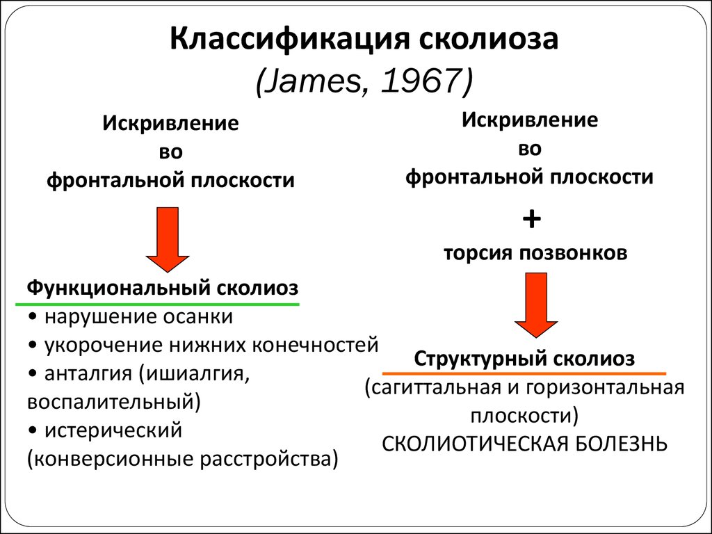 Классификация сколиоза