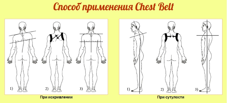 Применение корректора осанки Сhest Belt Применение корректора осанки Сhest Belt