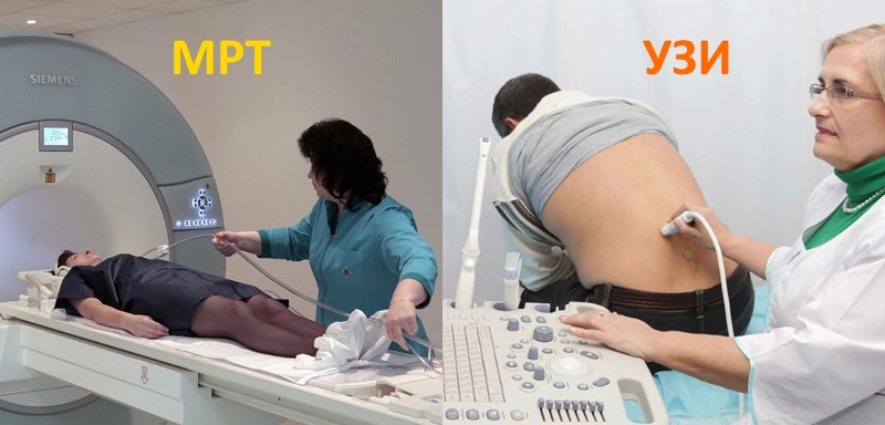 Диагностика травмы позвоночника Диагностика травмы позвоночника