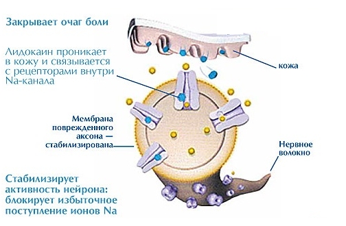 Механизм действия Лидокаина Механизм действия Лидокаина
