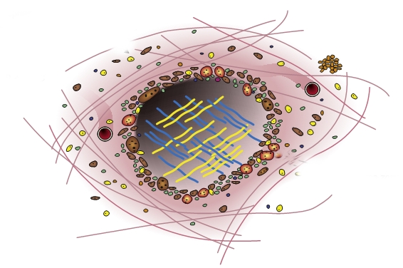 Модель подагрического тофуса Модель подагрического тофуса