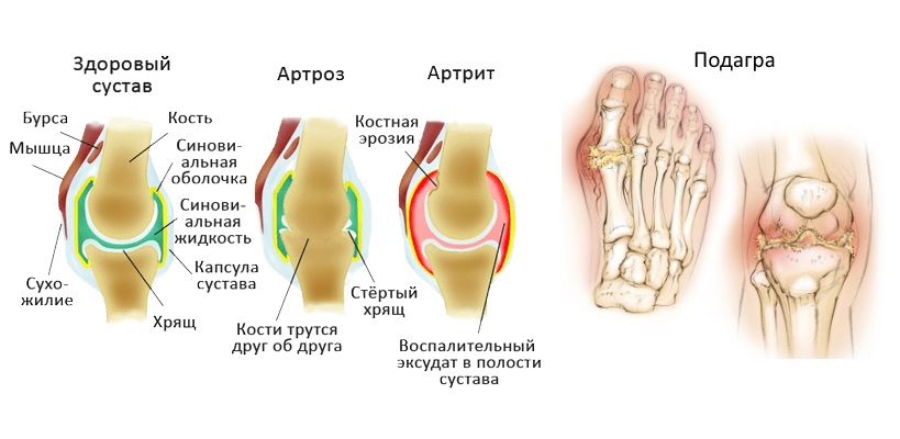 Назначение Суставикса Назначение Суставикса