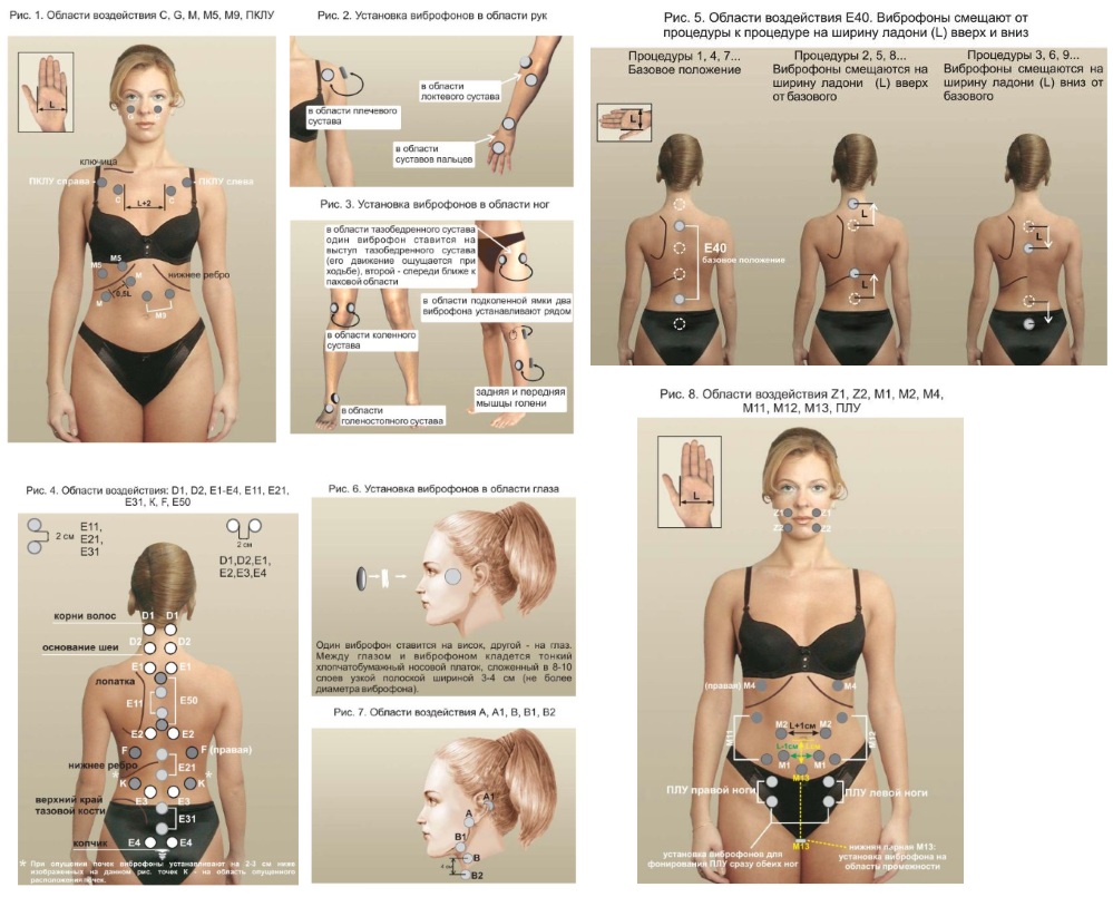 Области применения аппарата для фонирования Области применения аппарата для фонирования