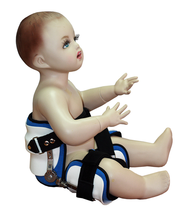 Применение ортезов при Х - образных ногах Применение ортезов при Х - образных ногах