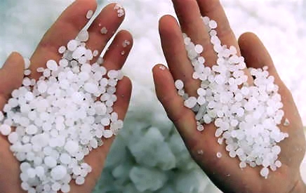 Деформация сустава из - за отложения солей Деформация сустава из - за отложения солей